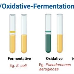 Phenol red fermentation coli alcaligenes faecalis bacteria broth lactose microbiology biochemical tubes carbohydrate