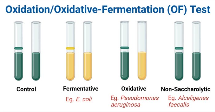 Phenol red fermentation coli alcaligenes faecalis bacteria broth lactose microbiology biochemical tubes carbohydrate